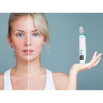 Beper - Uppladdningsbar porrensare USB/5V 400 mAh